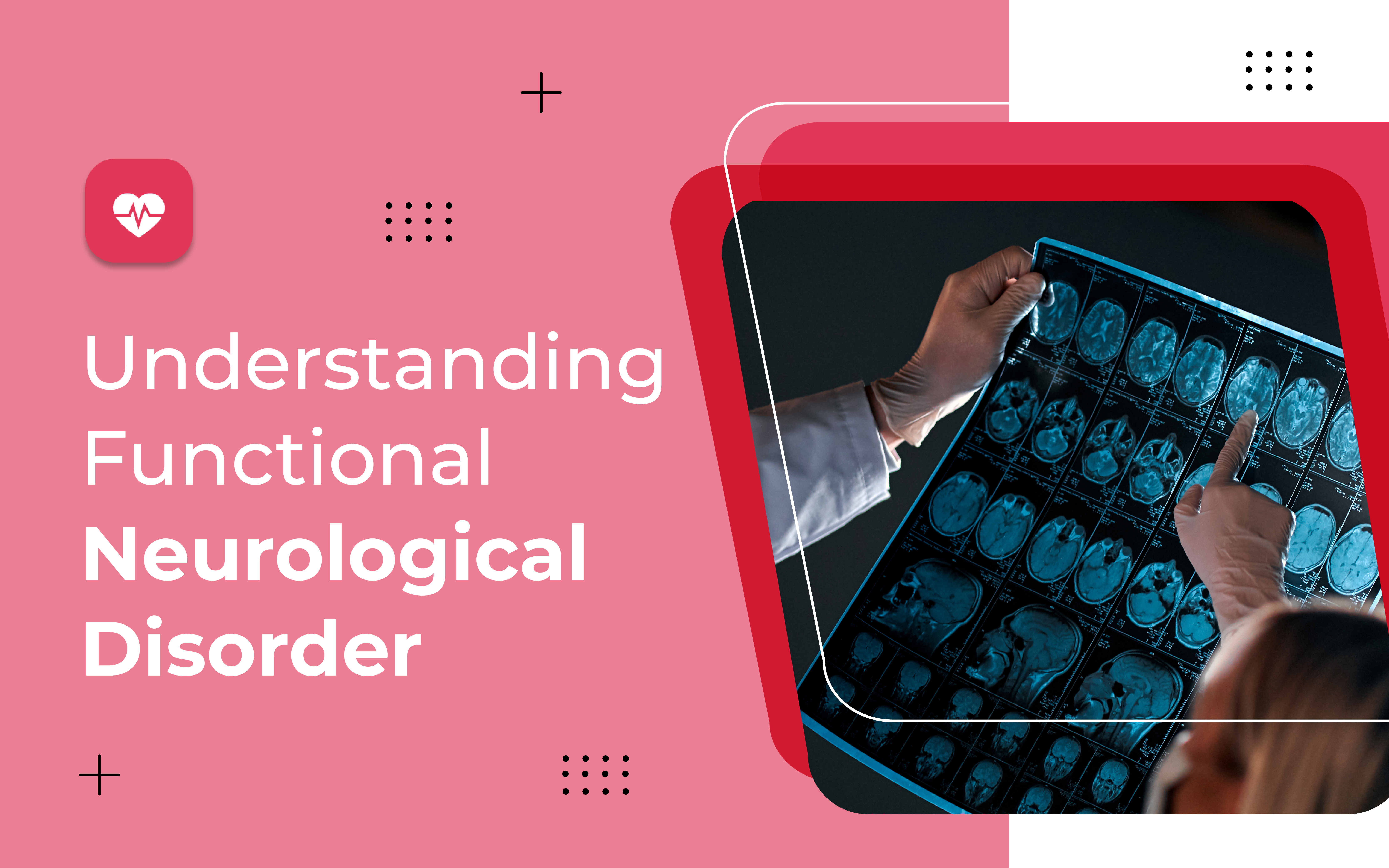 Understanding Functional Neurological Disorder